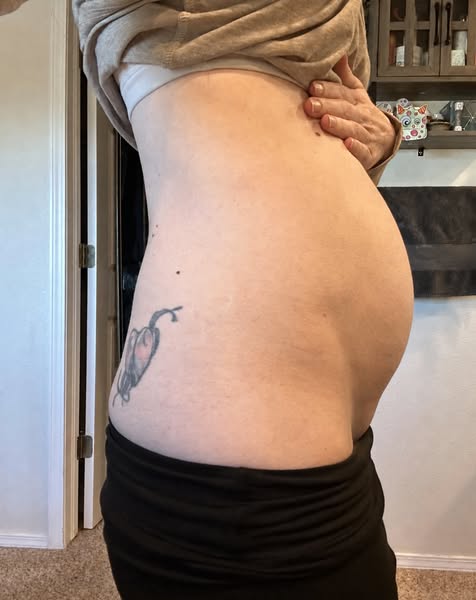 I Was Too Embarrassed to Mention the Bloat