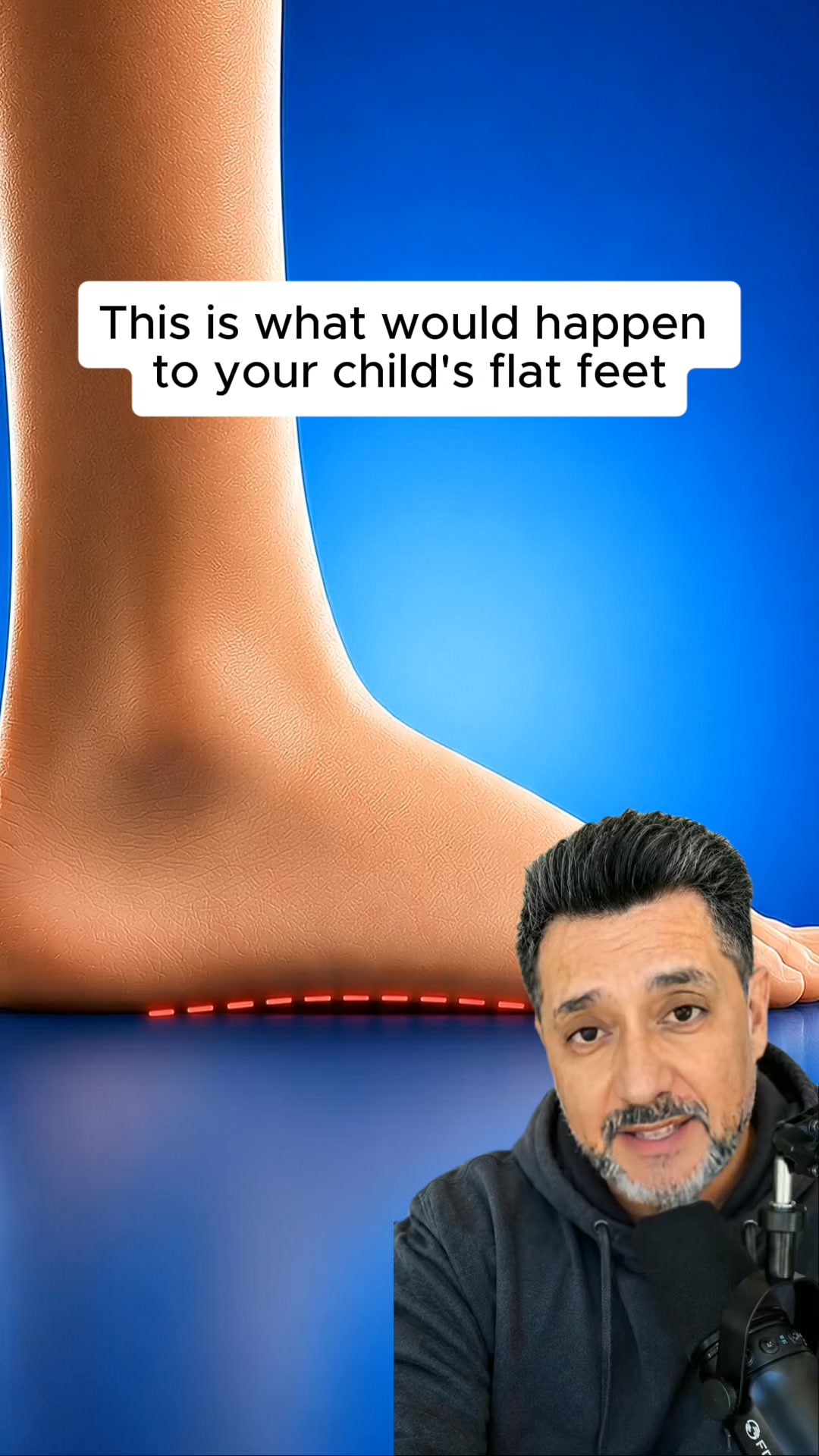 Support Flat Feet the Right Way