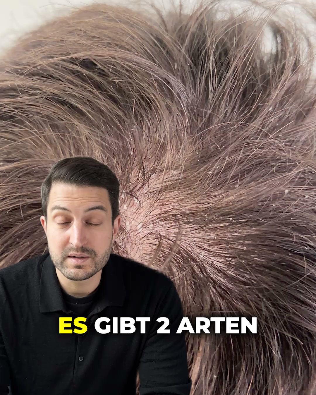Juckende Kopfhaut nervt? Mach Schluss damit.