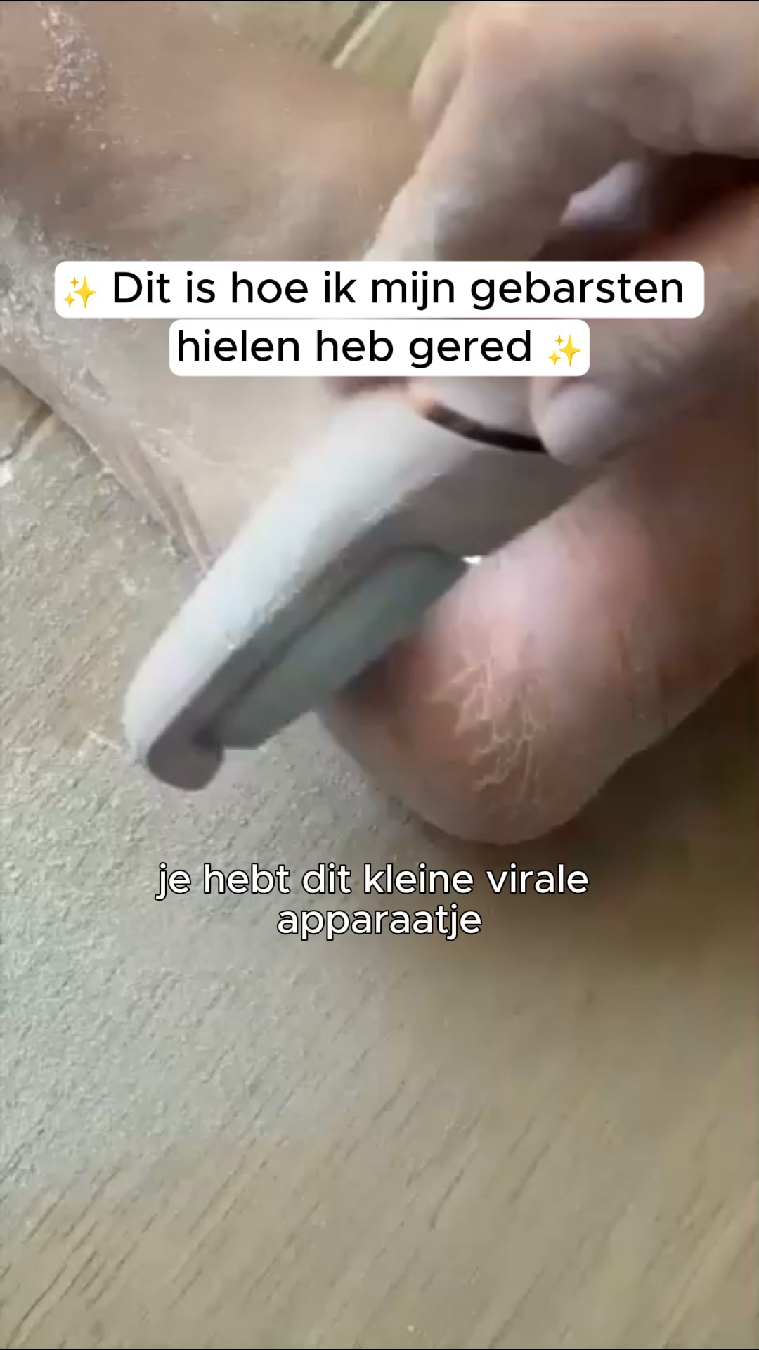 Het geheim voor gladde voeten