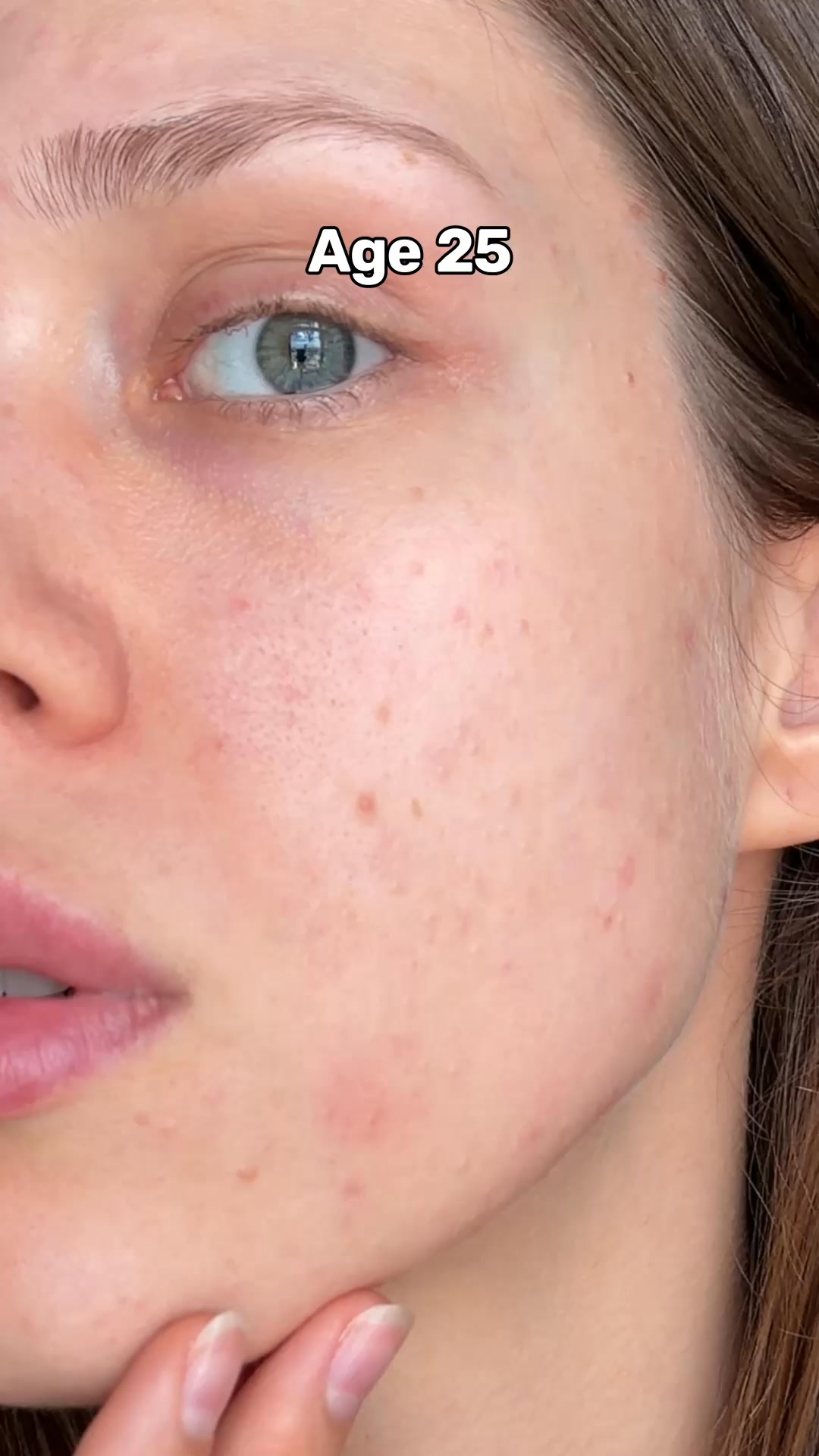 What Is Your Skin Missing?