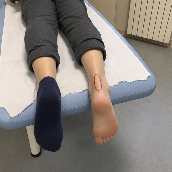 Leggi se hai la tendinite d'achille