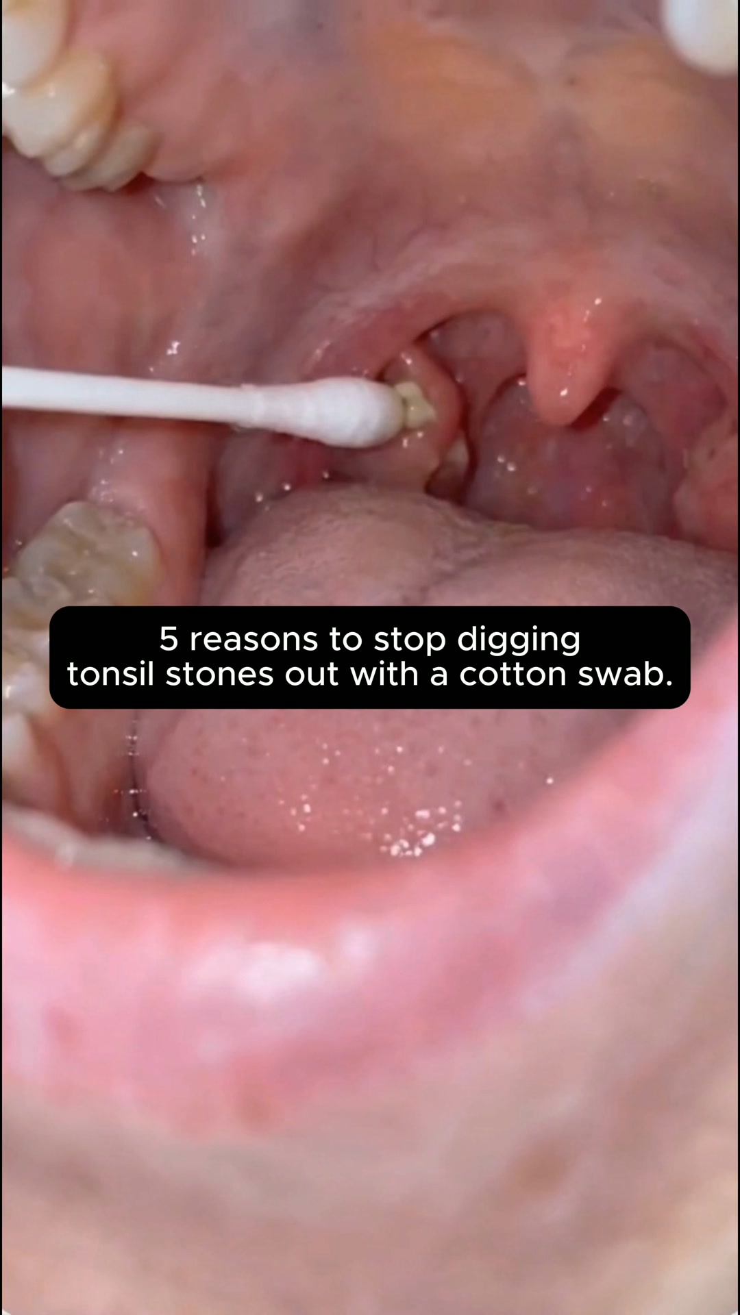 Why your breath never feels fresh