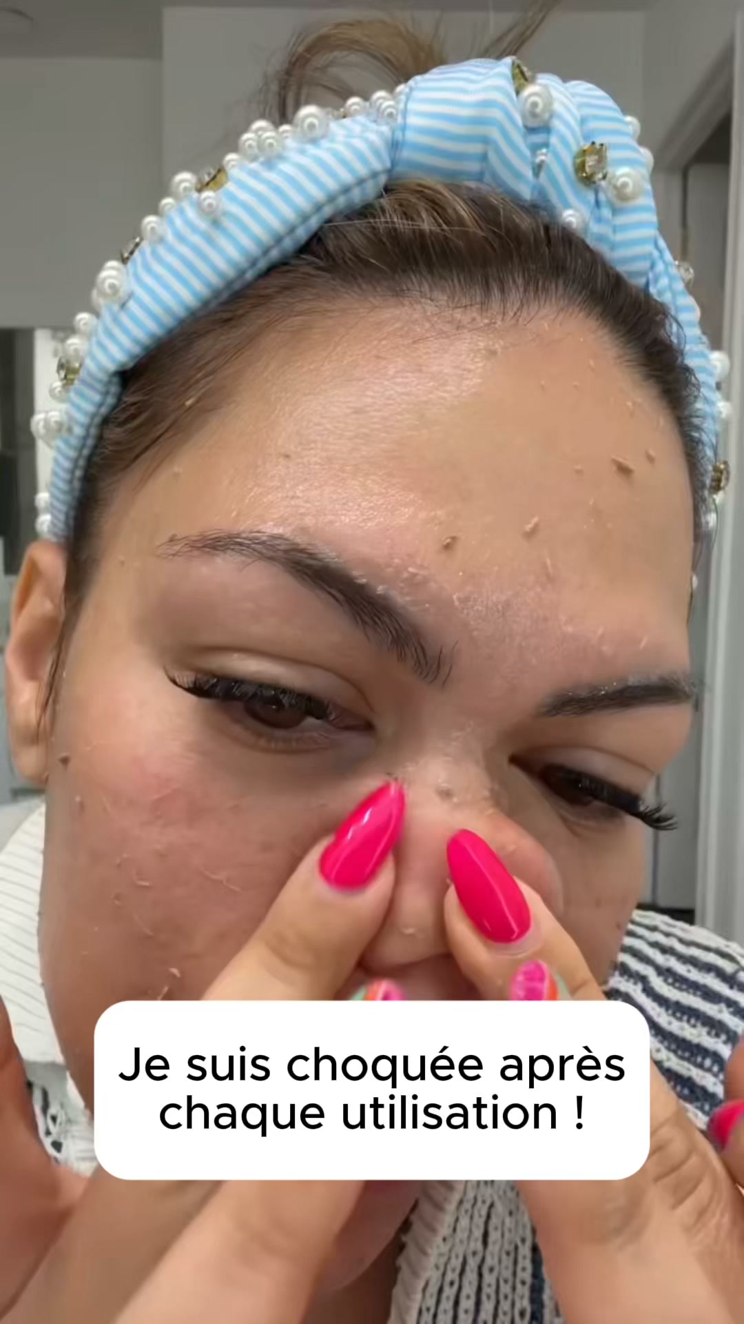 Dites Adieu aux Points Noirs À base de riz noir et niacinamide, ce sérum exfoliant nettoie les pores, lisse la peau et illumine le teint dès