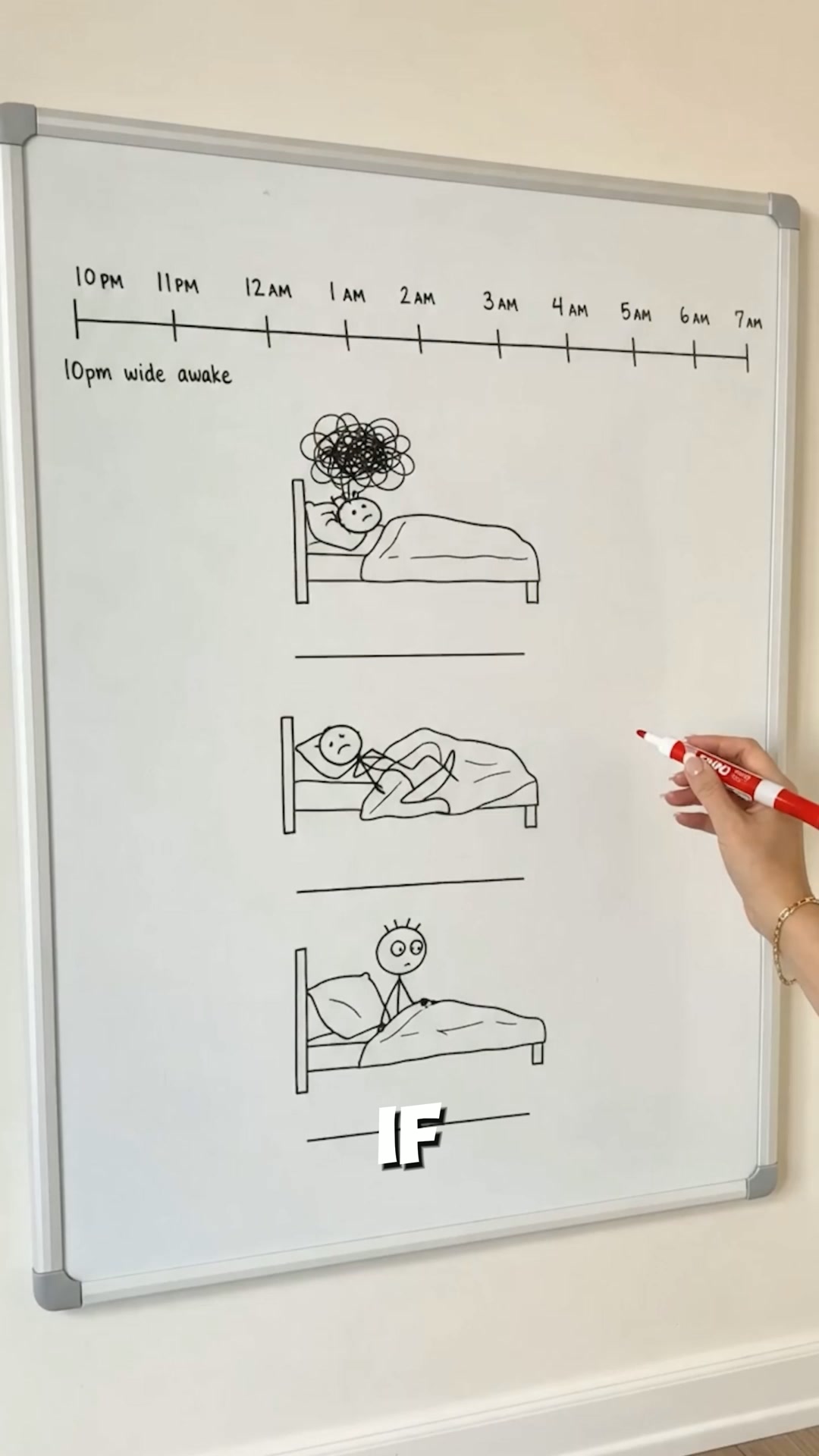 Sleep Support You Wear, Not Swallow