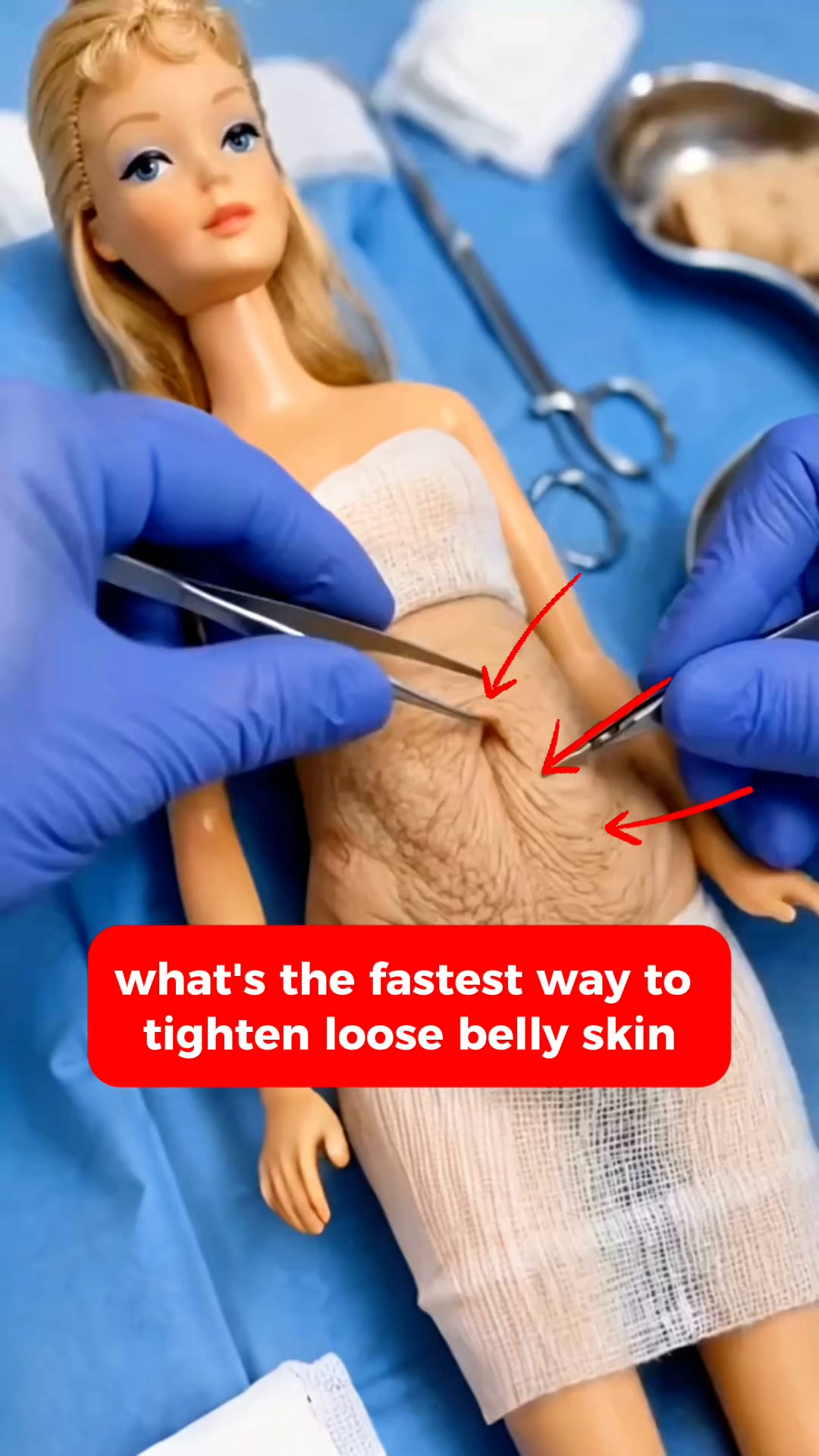 The layer that holds your stomach tight