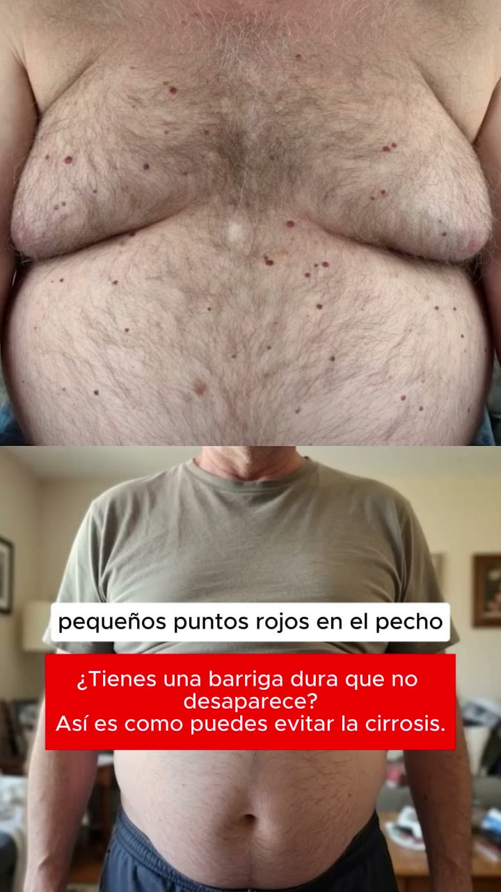 Lo que tus análisis aún no muestran — pero que tus riñones ya sienten