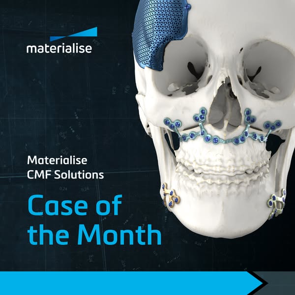Materialise Medical