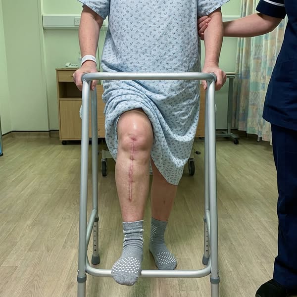 Knee Pain? Read this