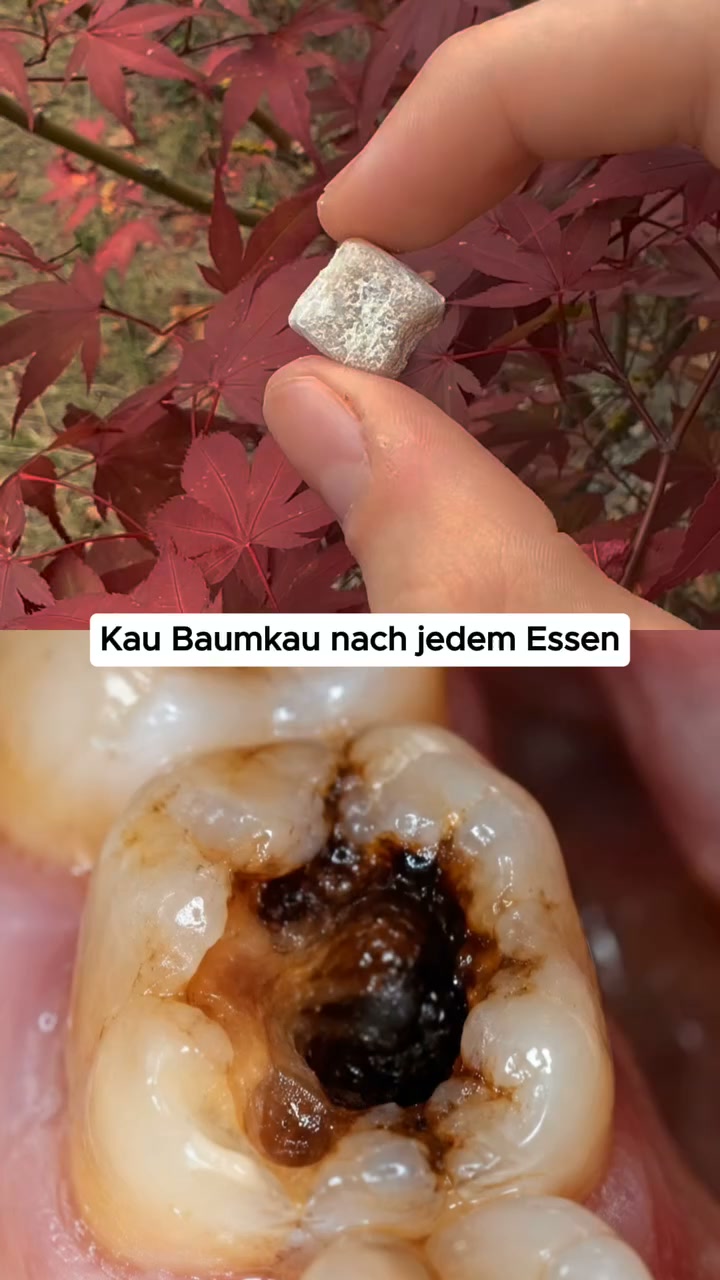 1 Kaugummi, der deine Zähne verändert.