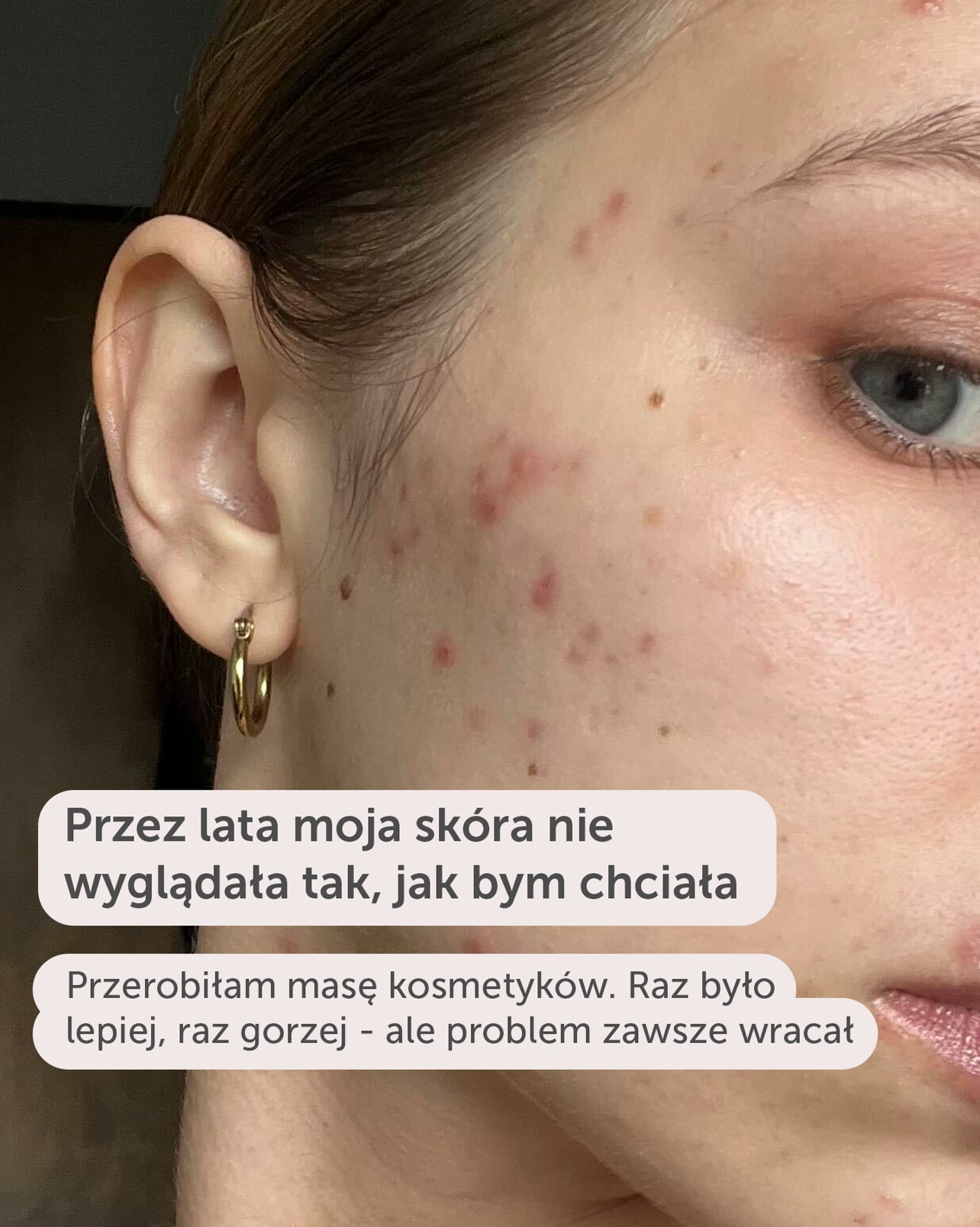 Odzyskaj naturalny glow skóry