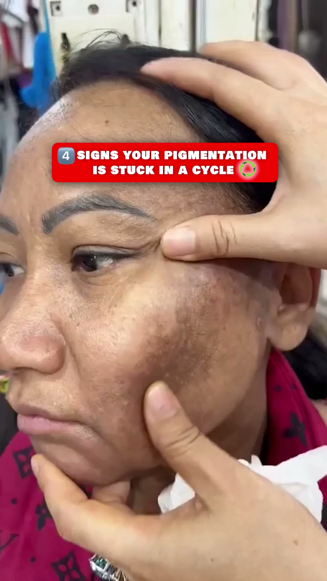 Visible Glow & Even Tone in 4 Weeks