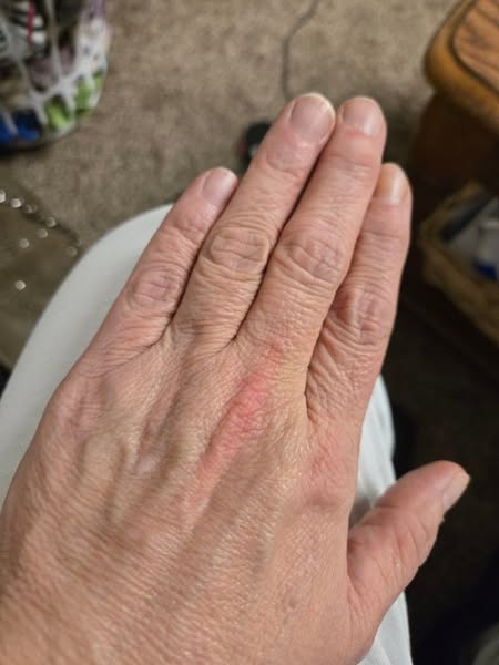 Women with arthritis: your heart is next