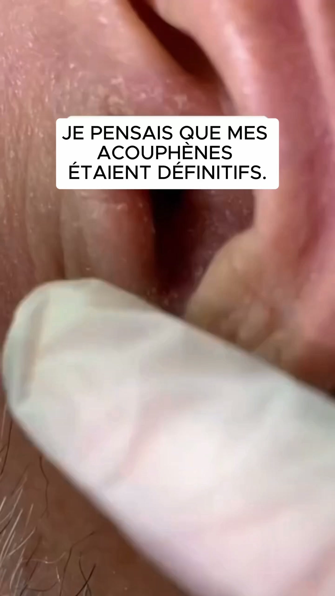 Acouphènes : cette histoire intrigue