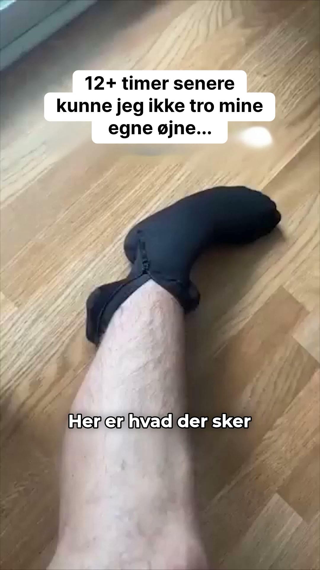 Slut med besværet med almindelige kompressionsstrømper!