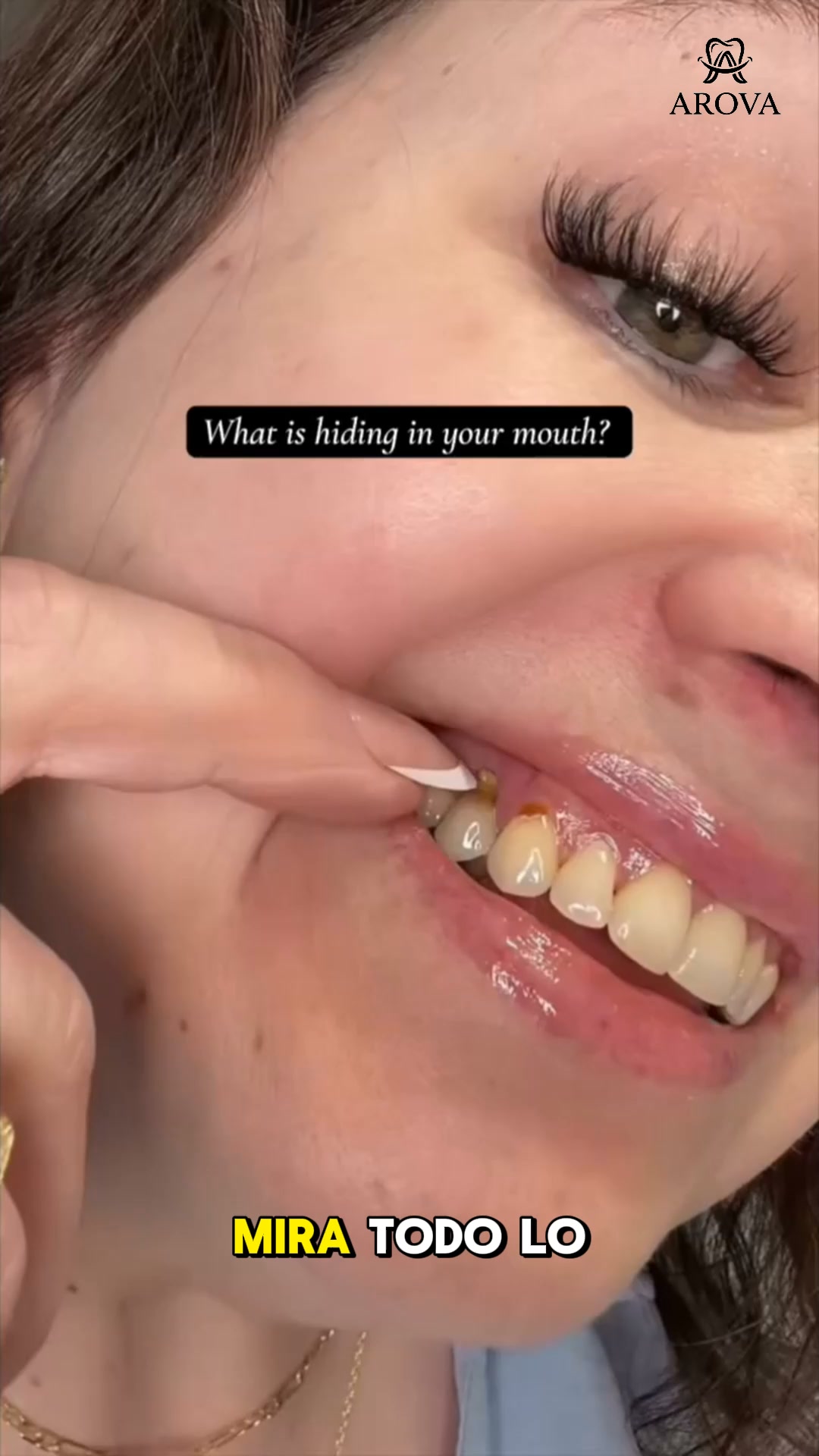 ¡No sabía todo lo que se quedaba en mis dientes hasta que probé esto!