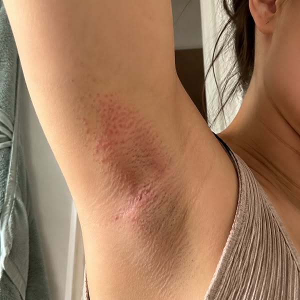 Shaved yesterday, already prickly? Here's why