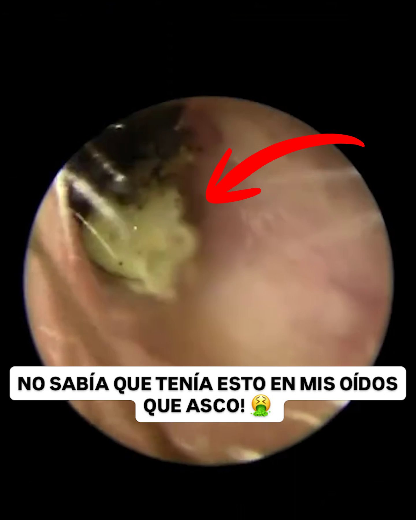 CONTRAREEMBOLSO