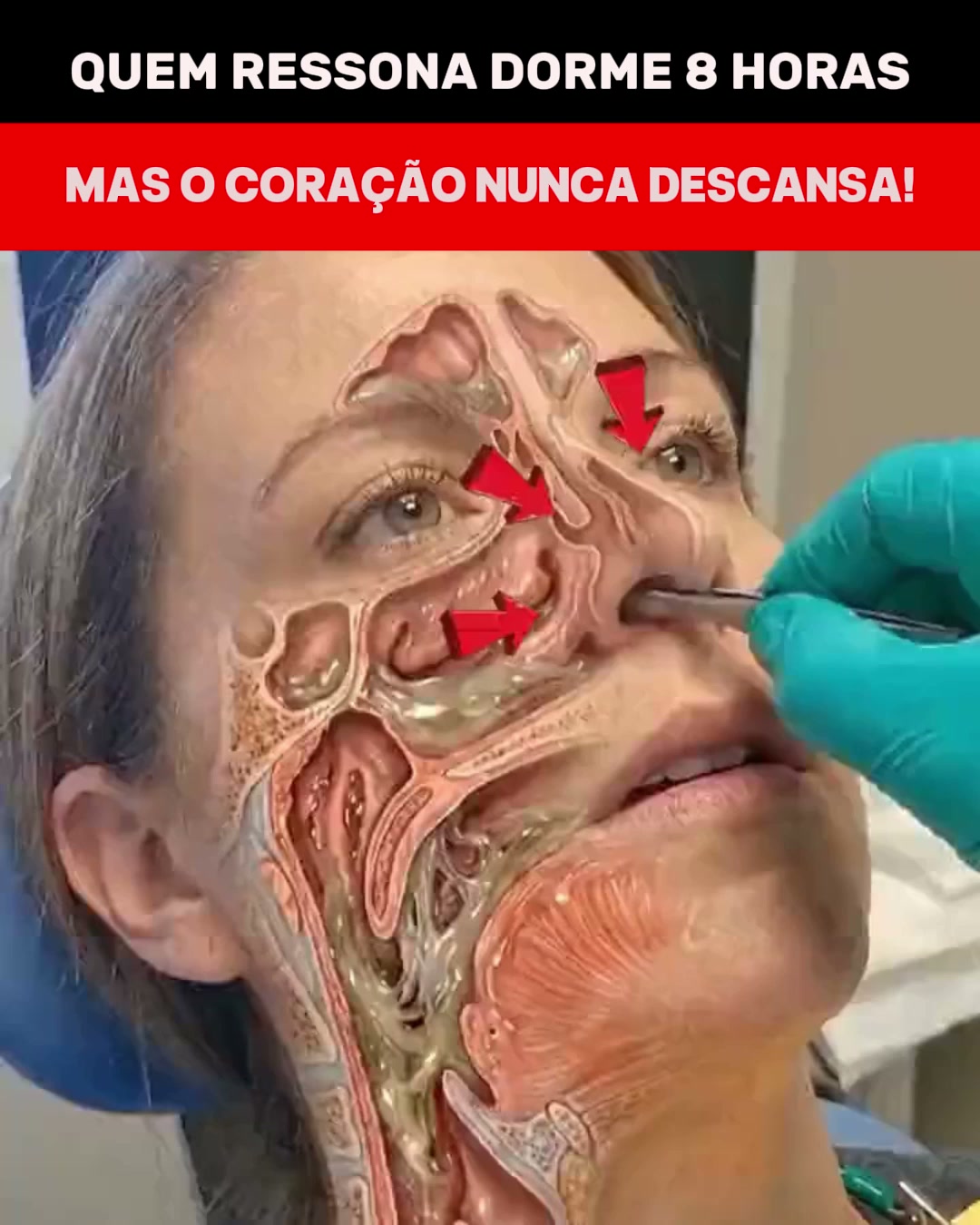 Elimine o ressonar logo a partir da primeira noite!