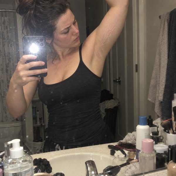 The Viral Gold Gel I Use On My Stretch Marks