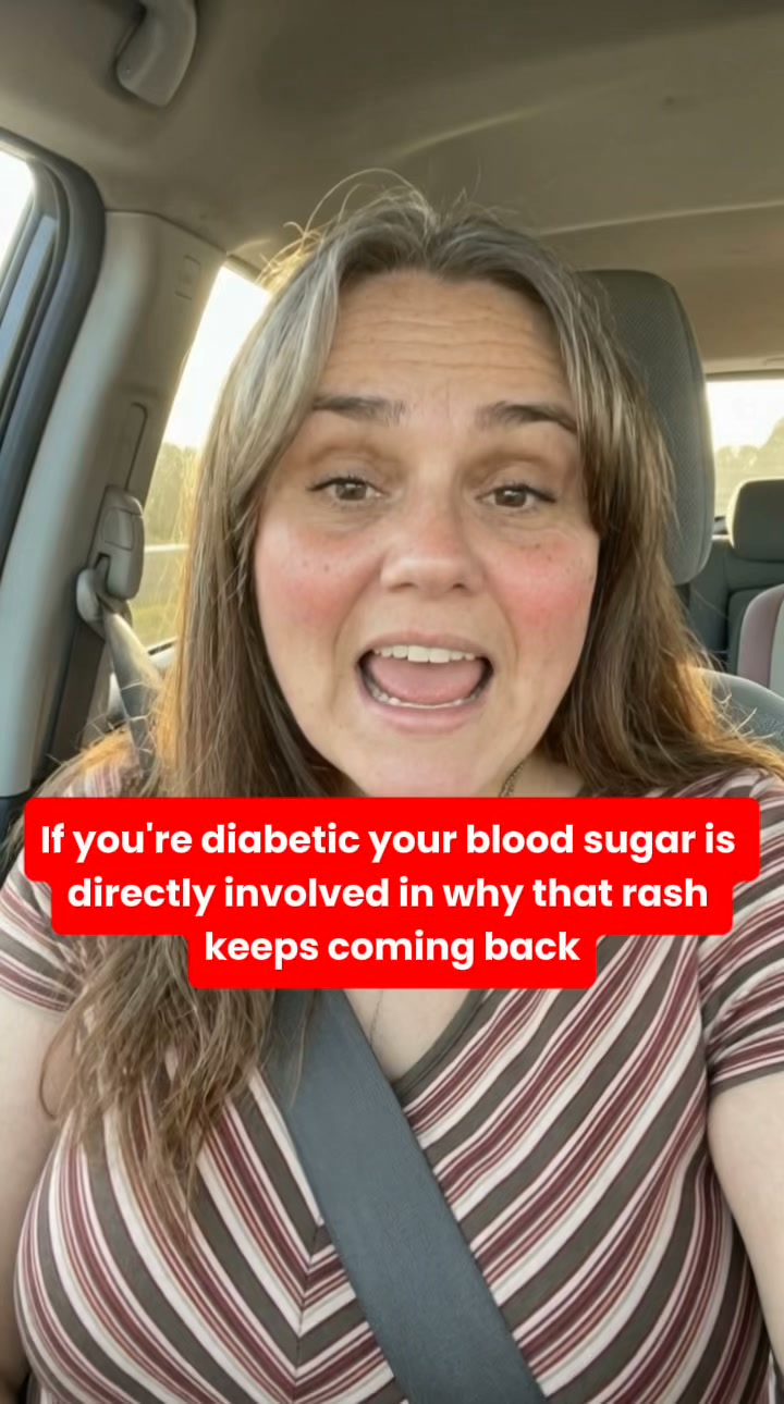 What Maui Taught Me About Skin Folds