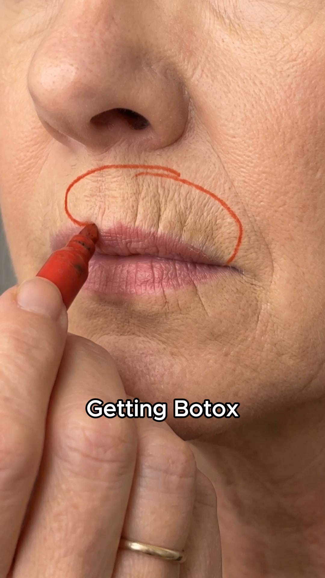 Stop using anti-aging product for lip lines