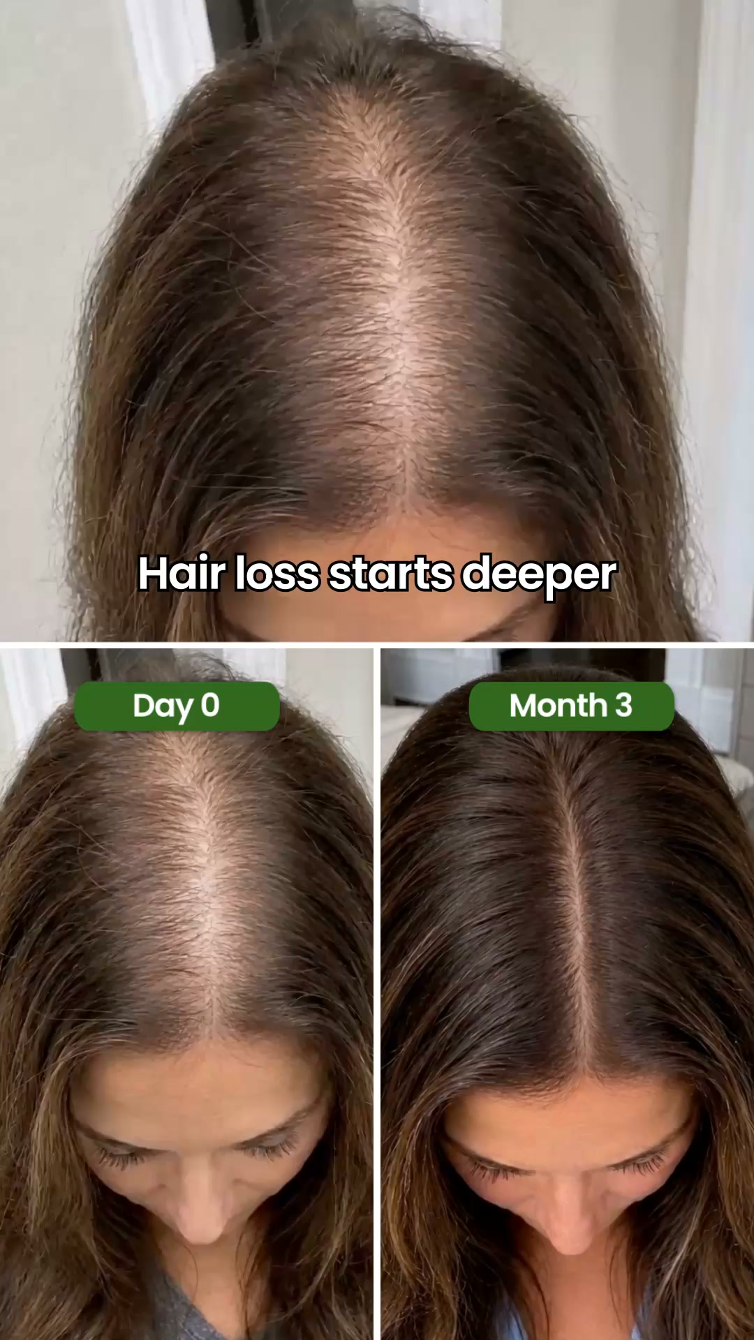 Up to 83% less hair loss