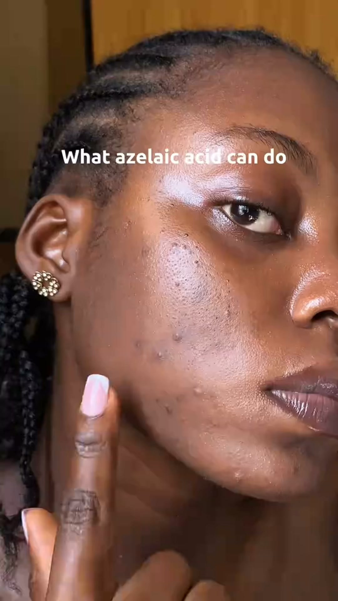 Calmer, Clearer-Looking Skin