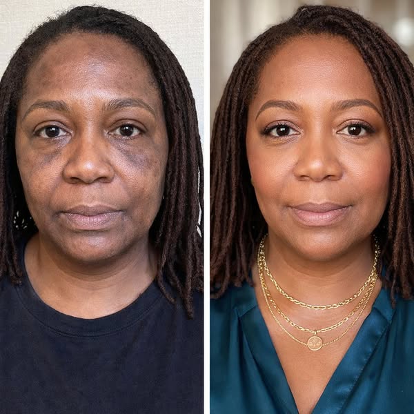 A new anti-wrinkle and dark spot serum