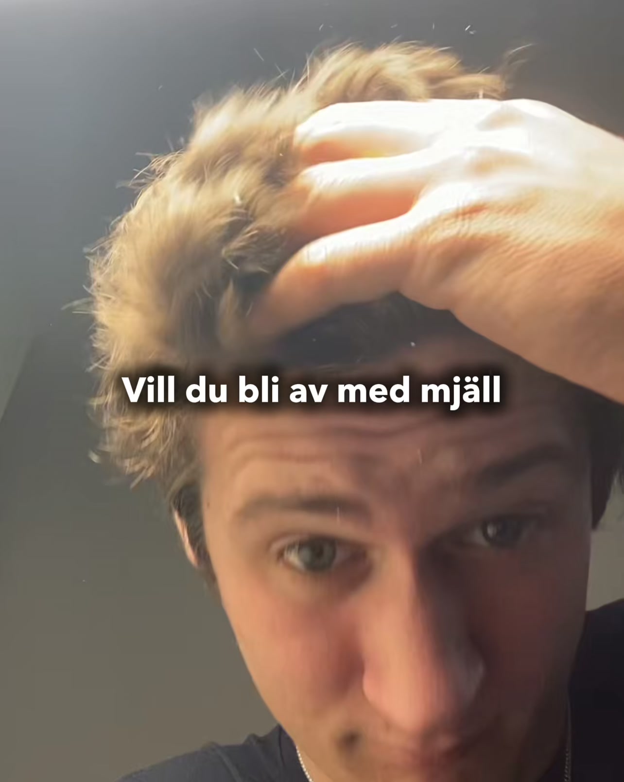Säg hejdå till mjäll, klåda och rodnad