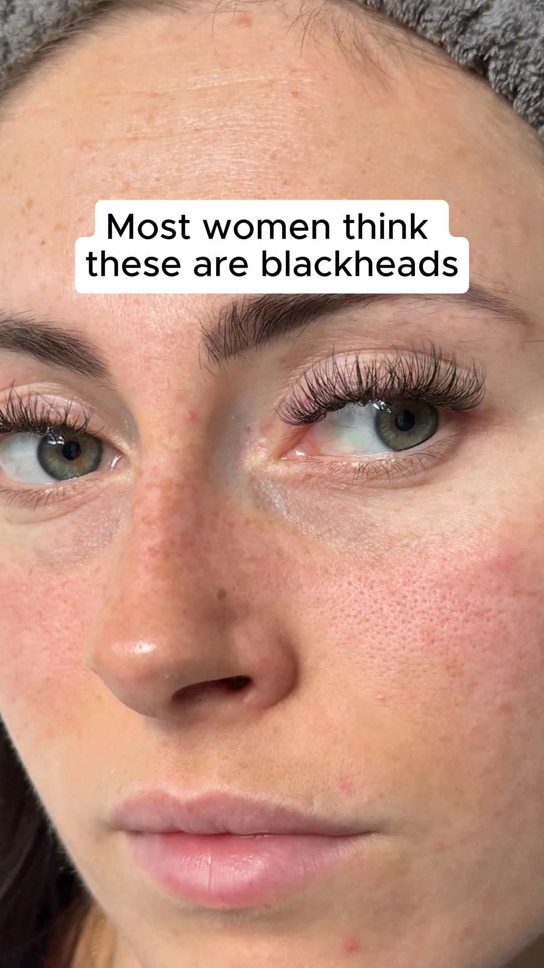 Clear Pores Overnight