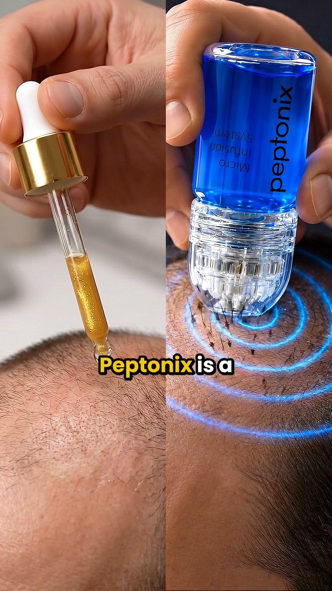 Restore Your Hair