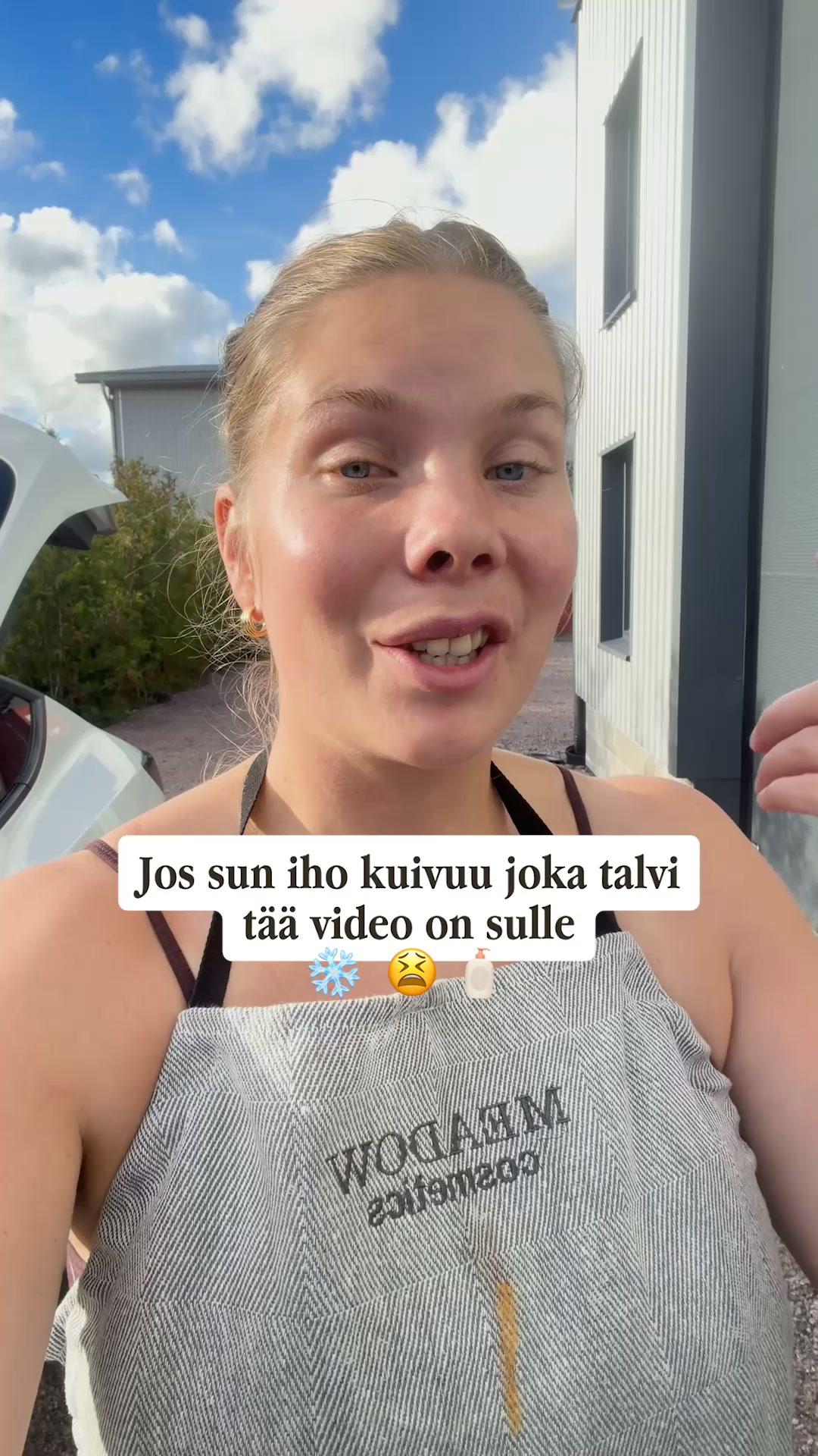 Jos ihosi kuivuu talvella, katso tämä