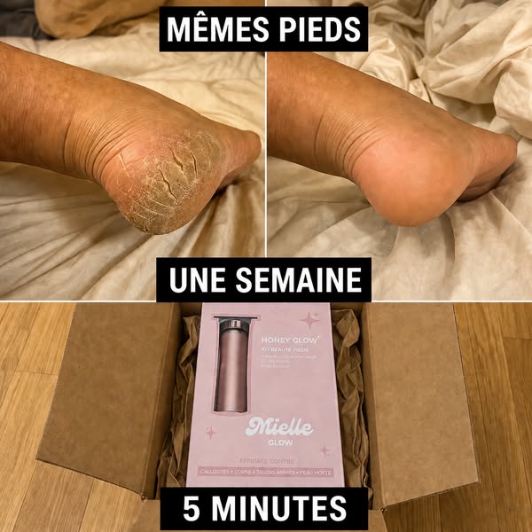 Trop gênée pour porter des chaussures ouvertes ?
