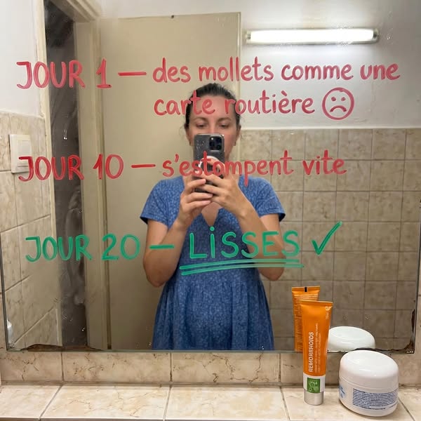 Vos veines méritent mieux que des jambes lourdes.