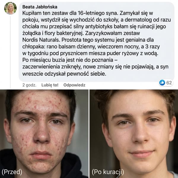 Cera trądzikowa lubi prostotę — 2 kroki dziennie