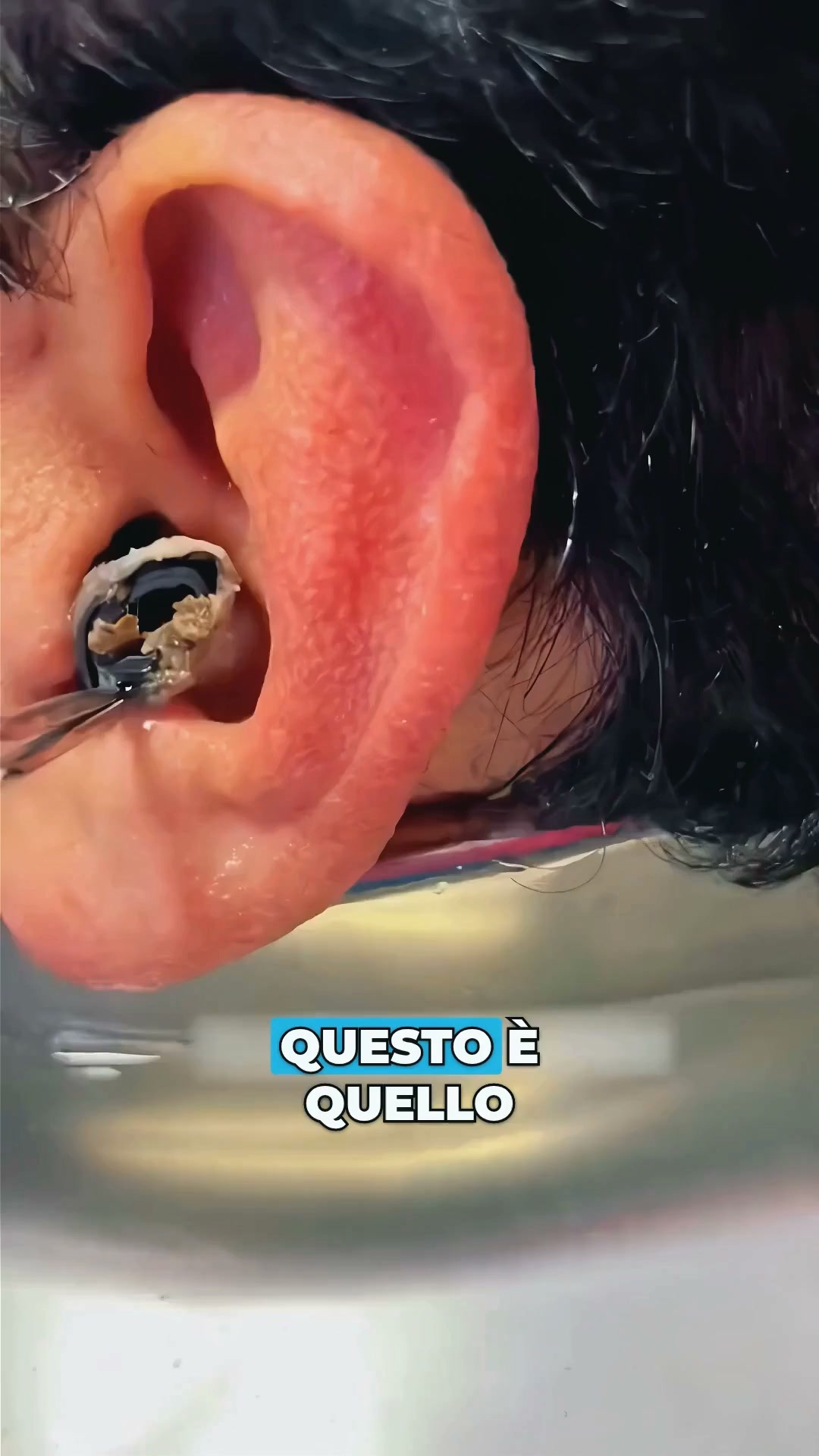Cattura il cerume invece di spingerlo