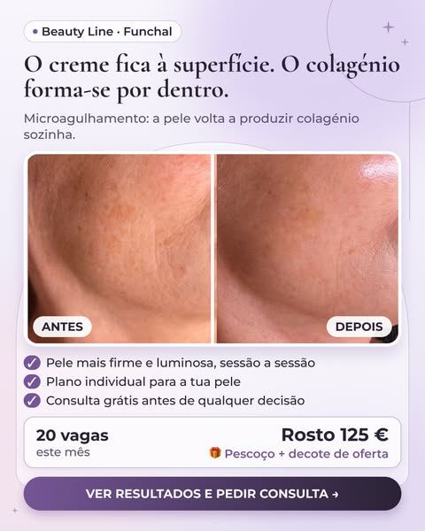Vê os resultados reais no site