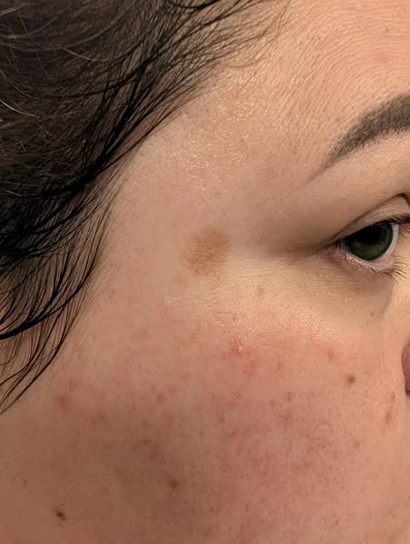 That spot is only the beginning.