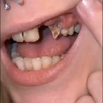 Tideglusib Tooth & Gum Repair Fast-Dissolving Oral Strips