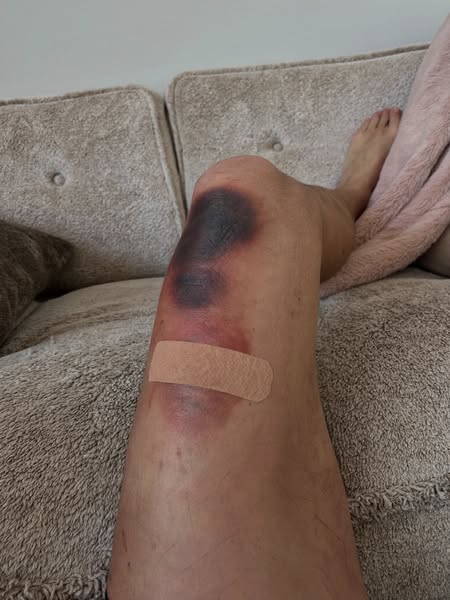 Read This If You Have Bad Knees