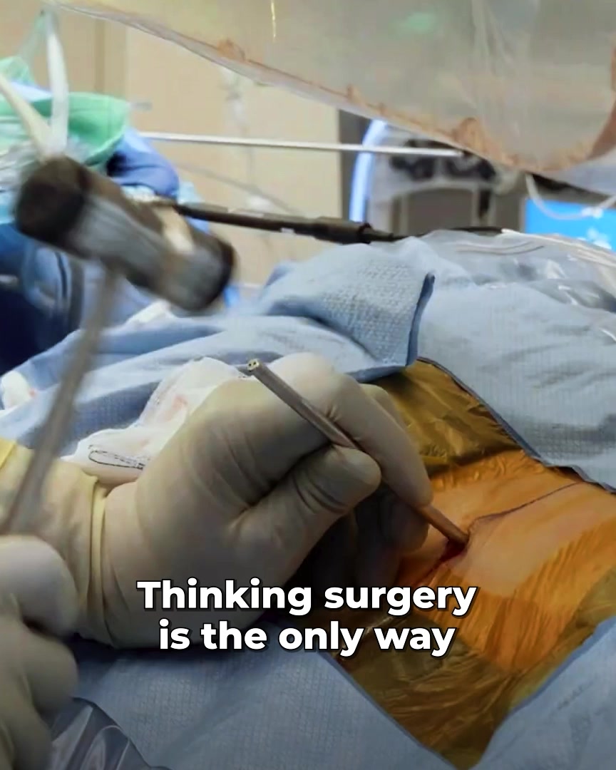 Try this before falling into sciatica surgery...