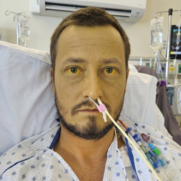 Doctors Told Him His Fatty Liver Was Incurable For 25 Years...