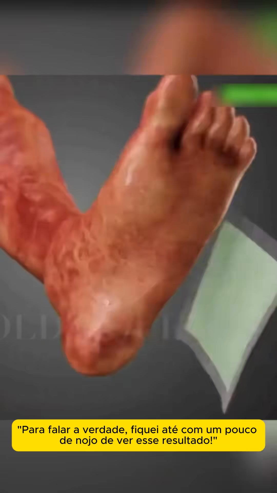 Kinoki Detox — Portes Grátis