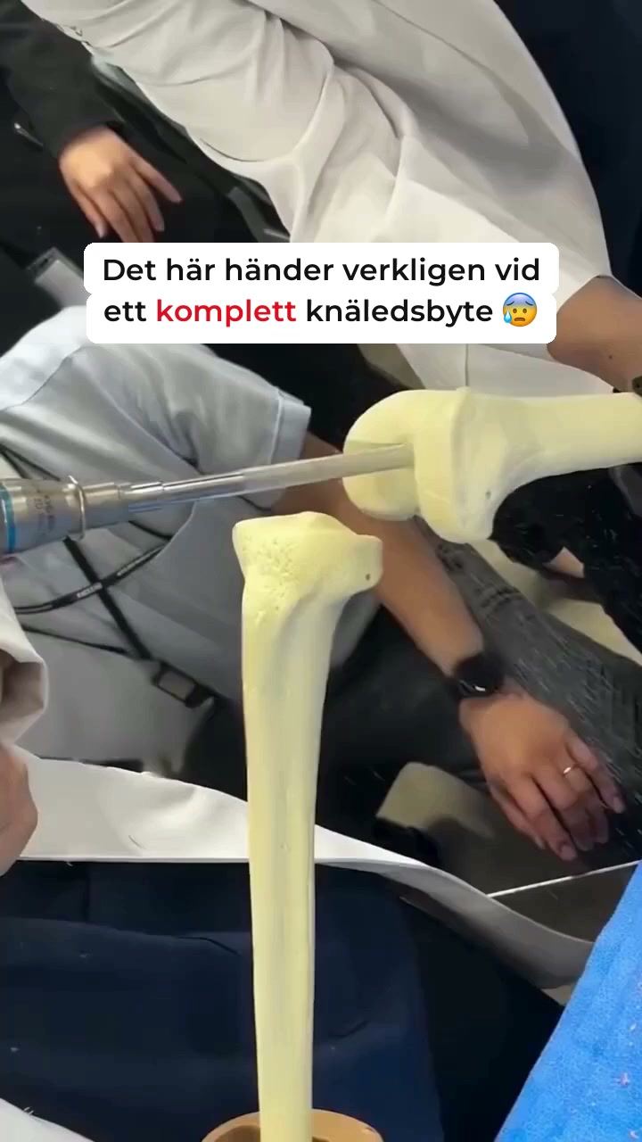 Knäsmärta eller artros?