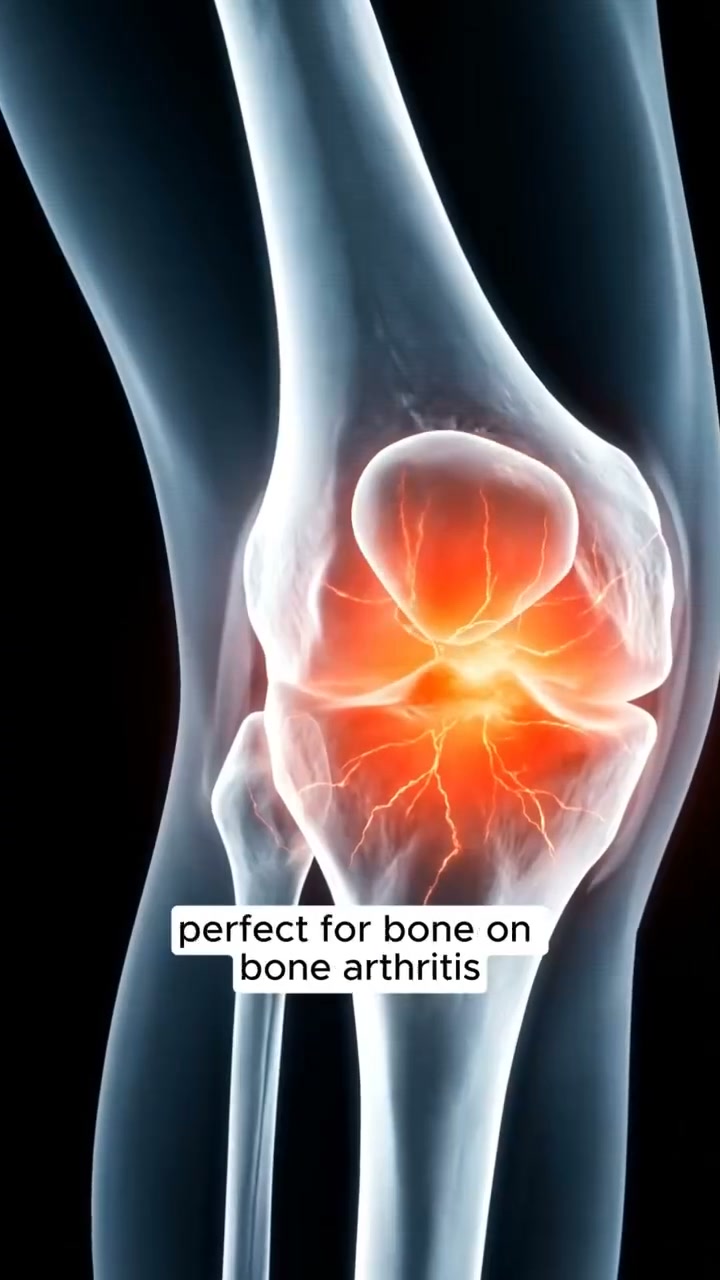 ANZEIGE: Final 3 hours Buy 1 Get 1 Free - Breathable Shock-Absorbing Patella Brace