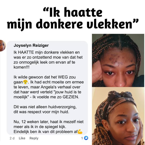 Vervaag Donkere Vlekken in 12 Weken