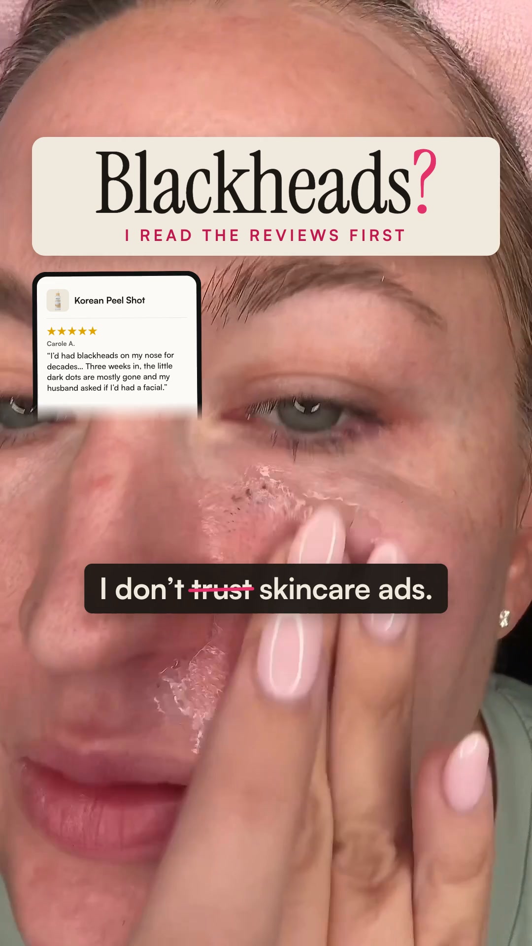 Say goodbye to blackheads