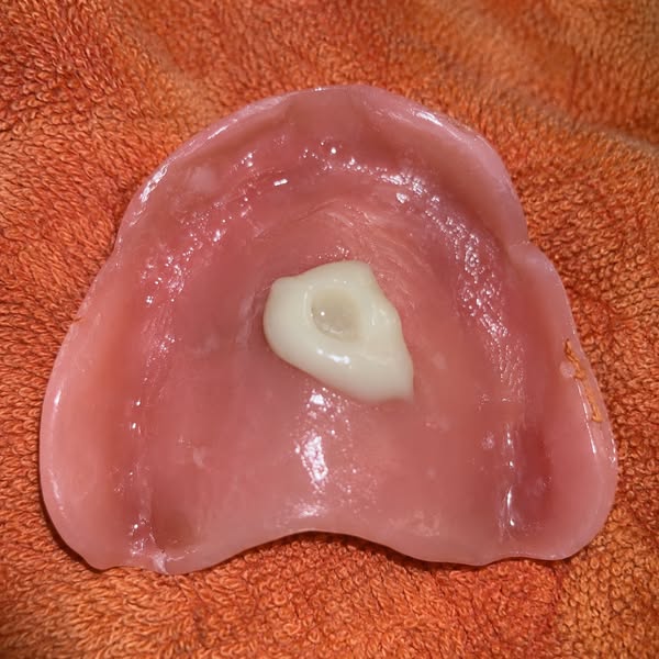 Read this if you wear dentures
