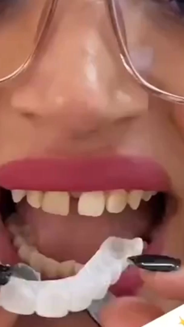 O seu sorriso pode mudar a forma como se sente